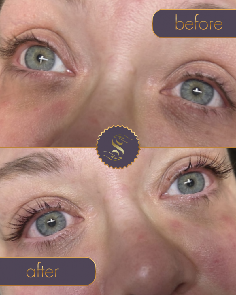 Stacey Before & After